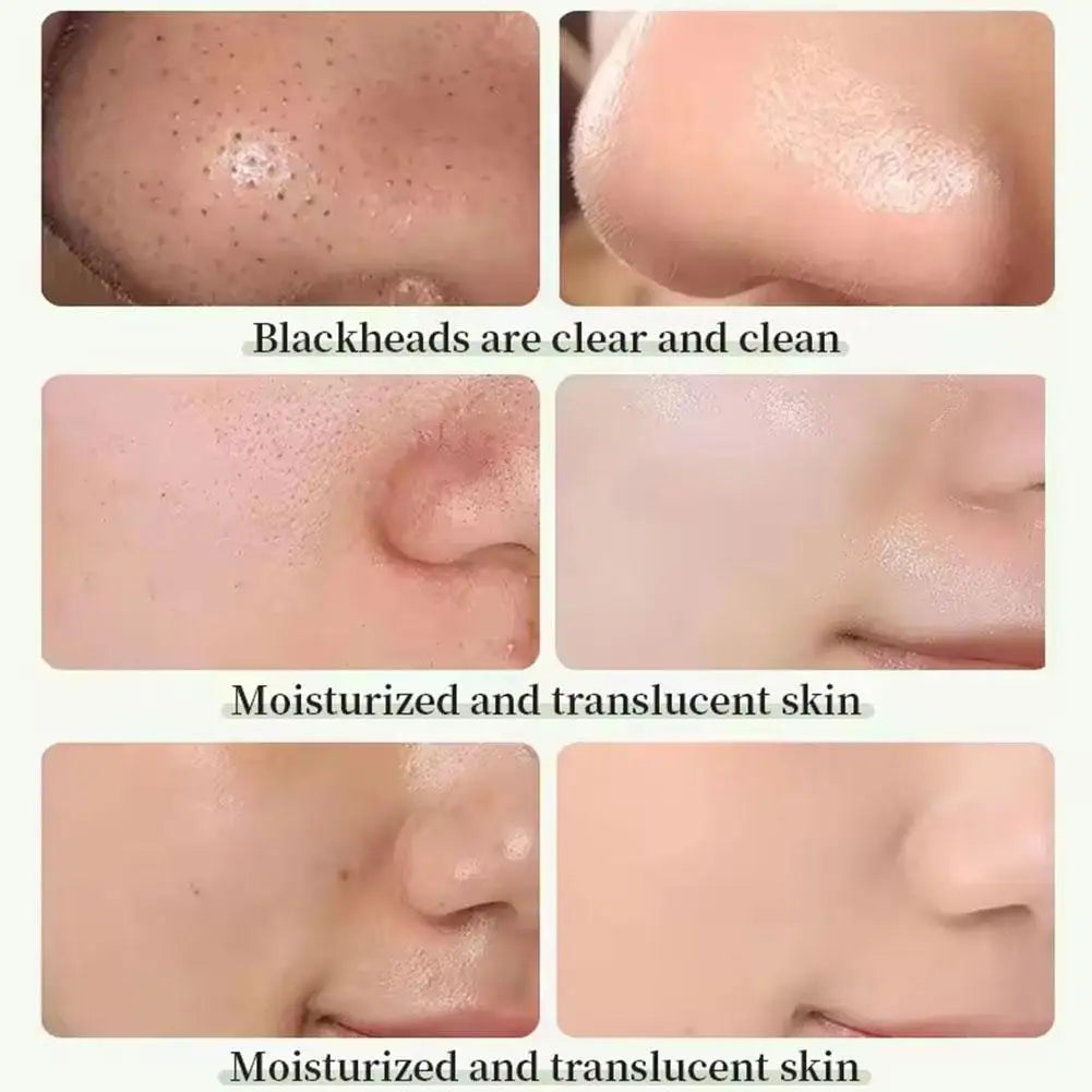 Green Tea Clay Stick For Face, Green Mask Stick Smear Acne Shrink Blackhead Green Tea Extract Facial Mask Pore Cleansing